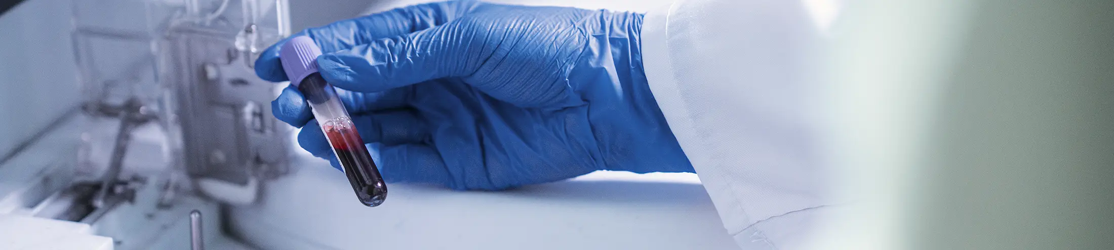 Laborator analize medicale Pitesti