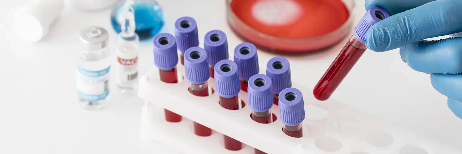 Analize medicale si la domiciliu pacientului